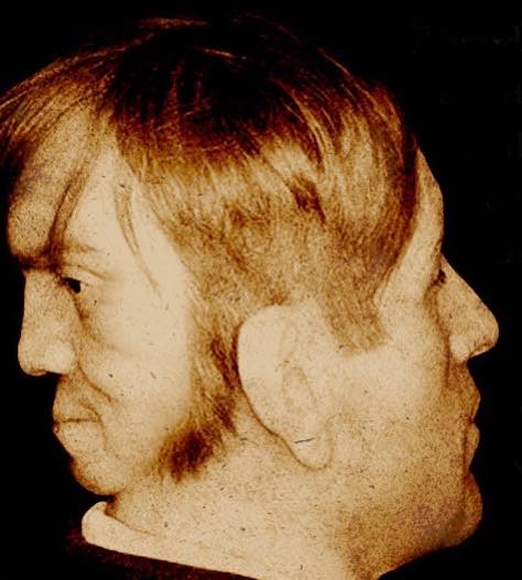 Valóban létezett a kétarcú férfi? Utánajártunk Edward Mordrake legendájának