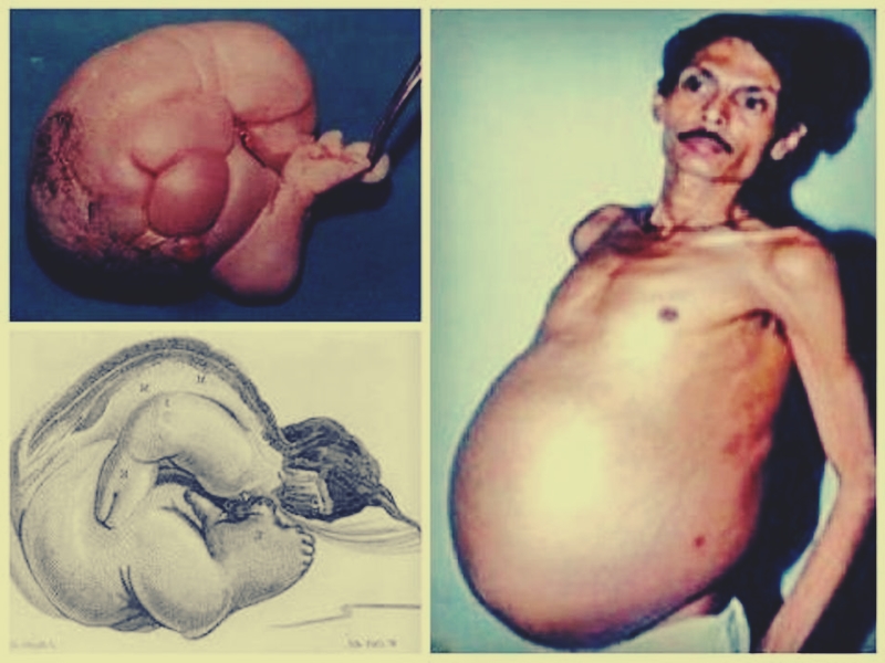 sanju-bhagat-pregnant-man.jpg