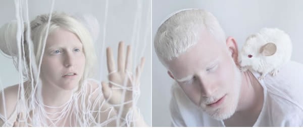 Ezek az albínók úgy néznek ki, mintha tündérek lennének